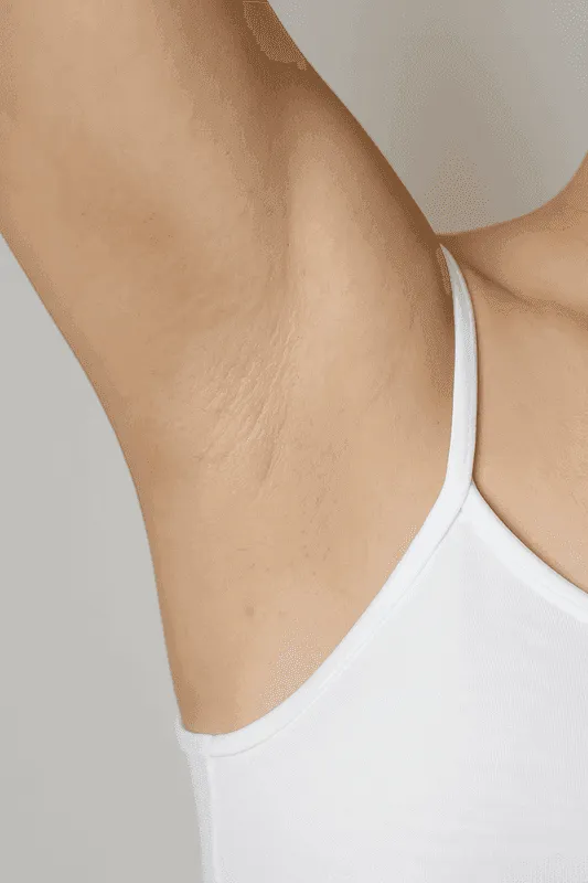 Underarm Waxing Results - After